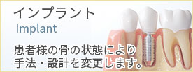 インプラント　患者様の骨の状態により、手法・設計を変更します。